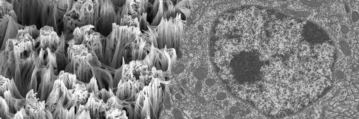 電子顕微鏡によるシリコンナノワイヤのSEM観察像とマウス小脳のTEM観察像のイメージ